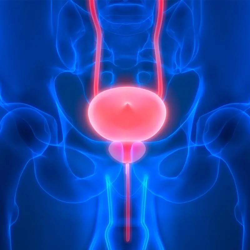 Robótica e o Câncer de Próstata