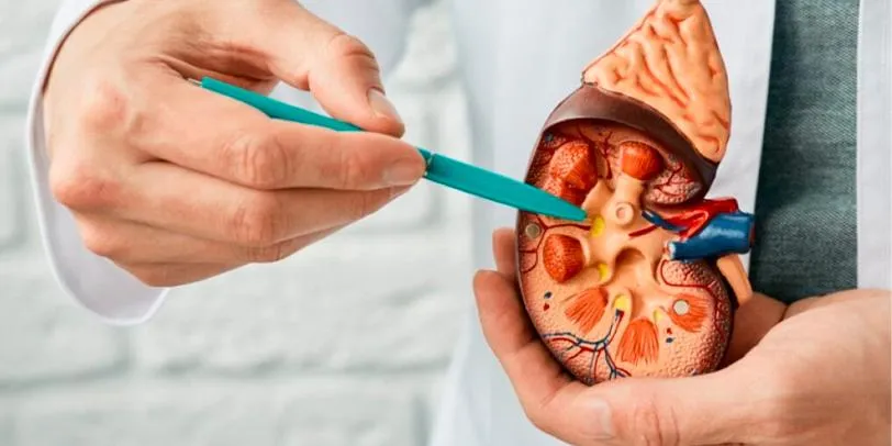 Pedras nos Rins: Entendendo as Causas, Tratamentos e Prevenção — Um Guia Completo por Dr. Fernando Marsicano