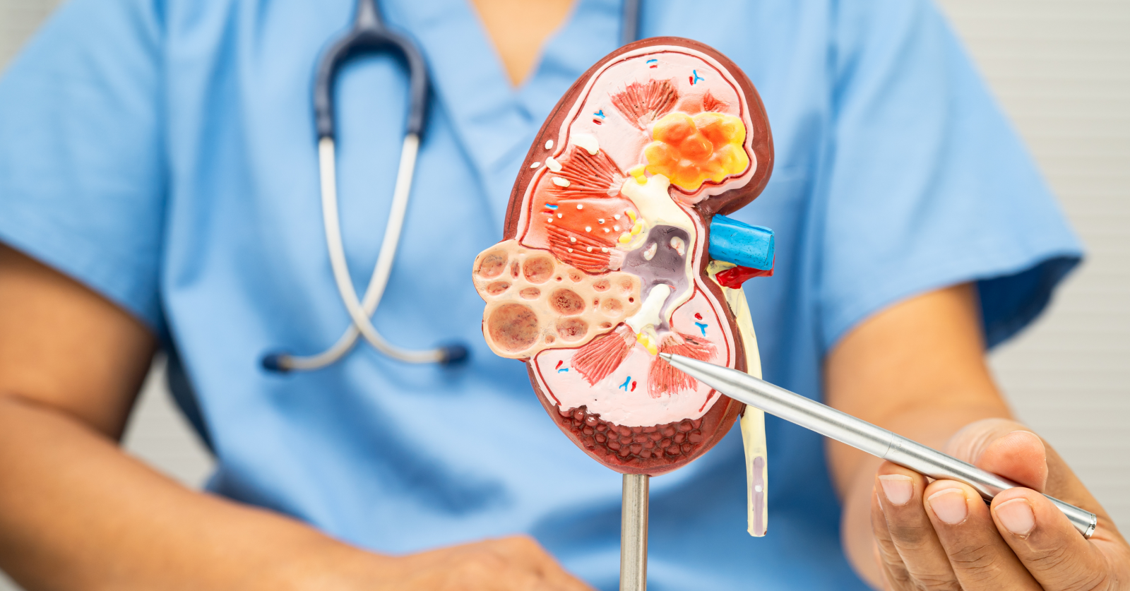 Cirurgia Robótica e Câncer de Bexiga: Como a Tecnologia Está Transformando o Tratamento Urológico