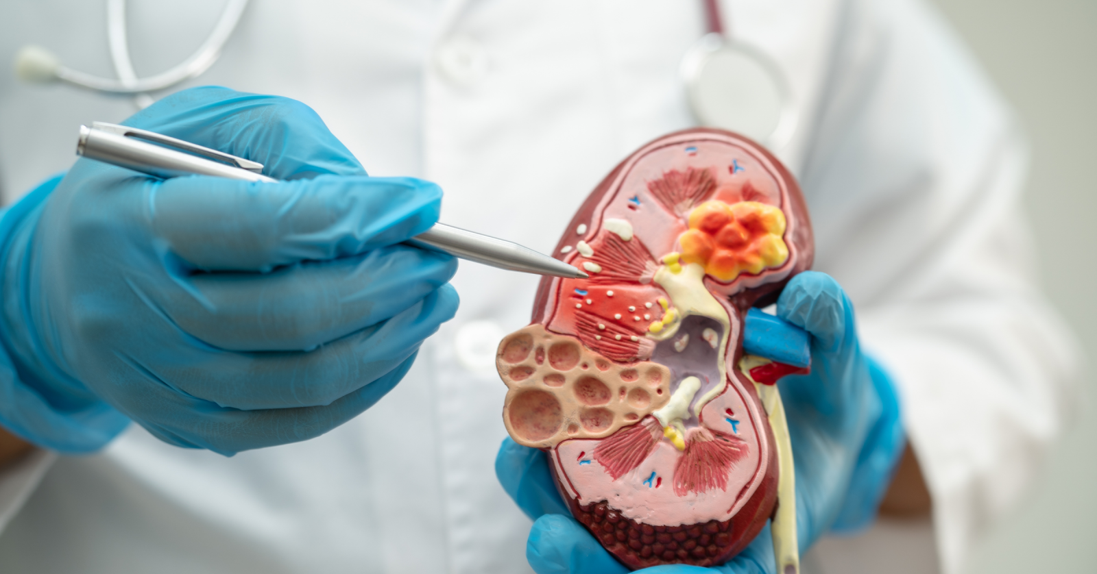 Quando Procurar um Urologista? Sinais de Alerta Que Você Não Deve Ignorar